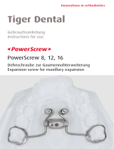 Tiger Dental PowerScrew 16 Instructions For Use Manual
